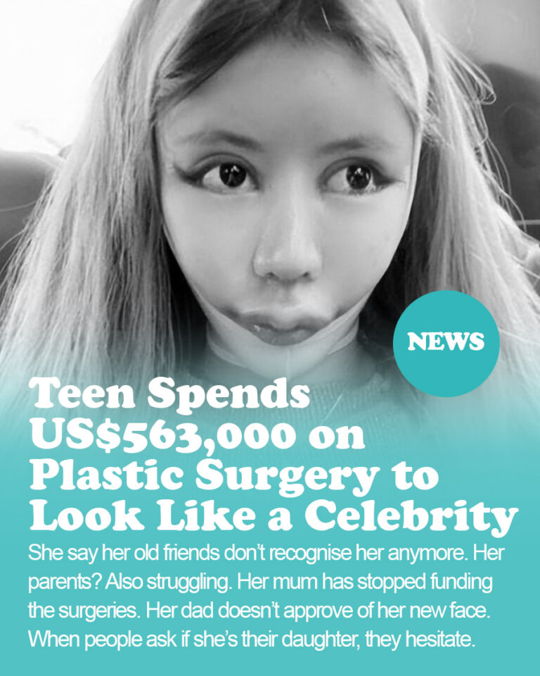 Teen Spends US$563,000 on Plastic Surgery to Look Like a Celebrity — Doctors Say One More Op Could Kill Her